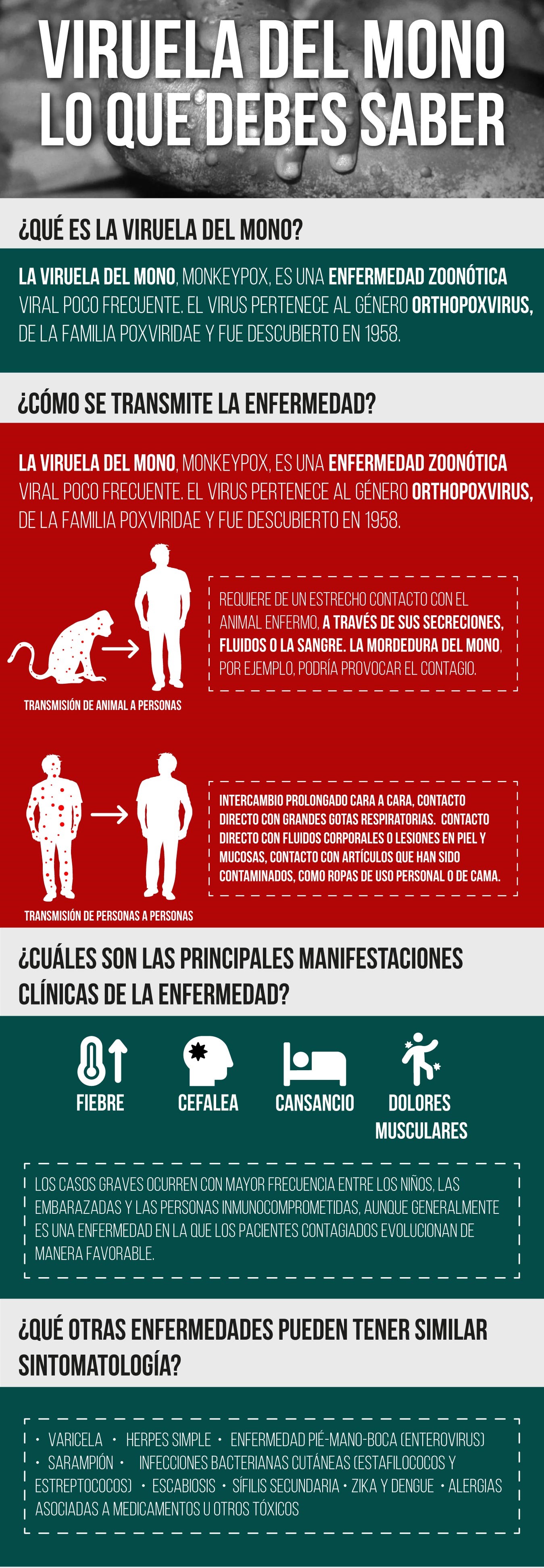 Viruela del mono editado1 Viruela del mono editado1