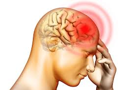 Estrategias para prevenir los accidentes cerebrovasculares Estrategias para prevenir los accidentes cerebrovasculares