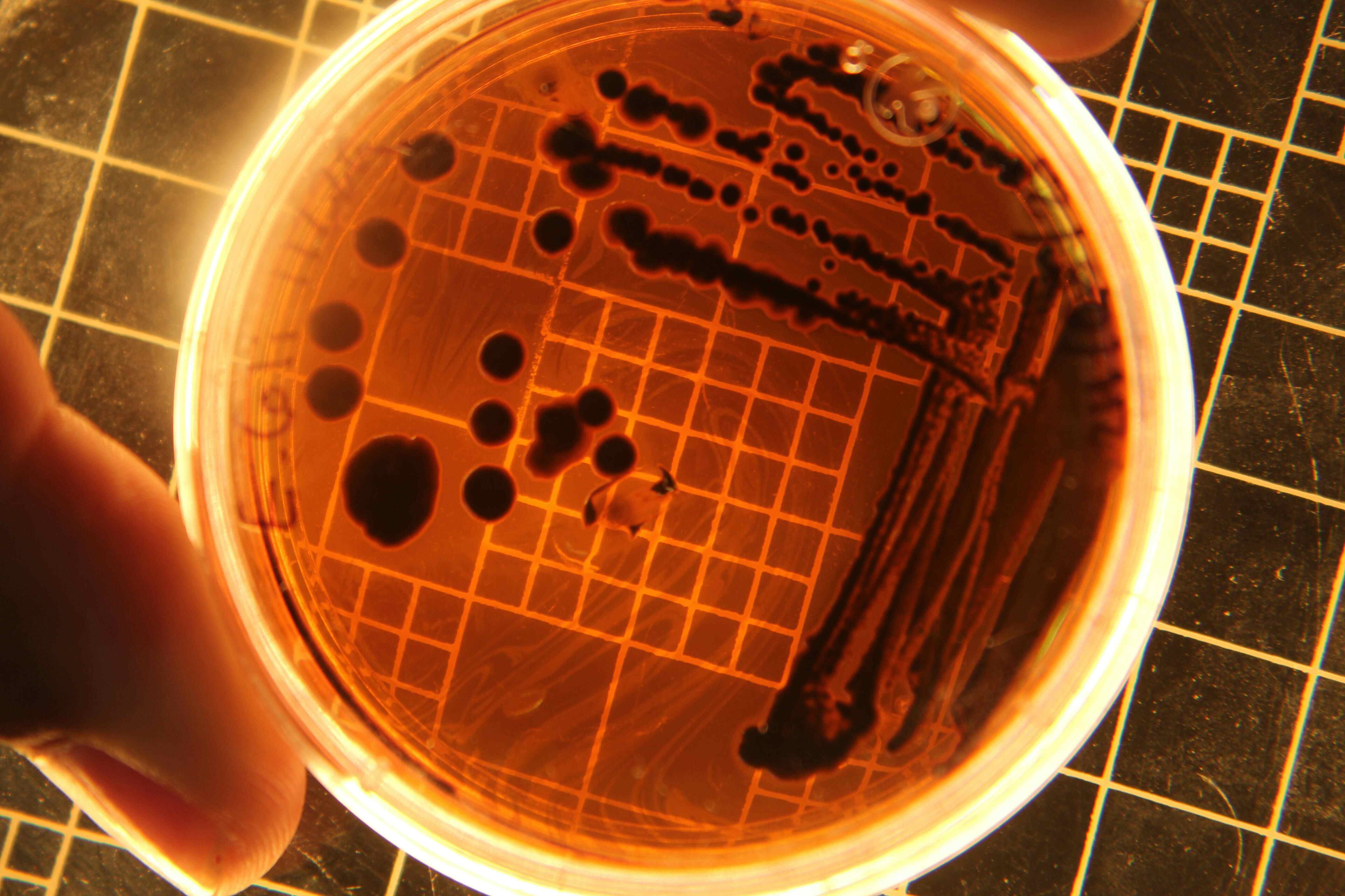 Arte en agar, fusión entre la microbiología y las expresiones visuales
